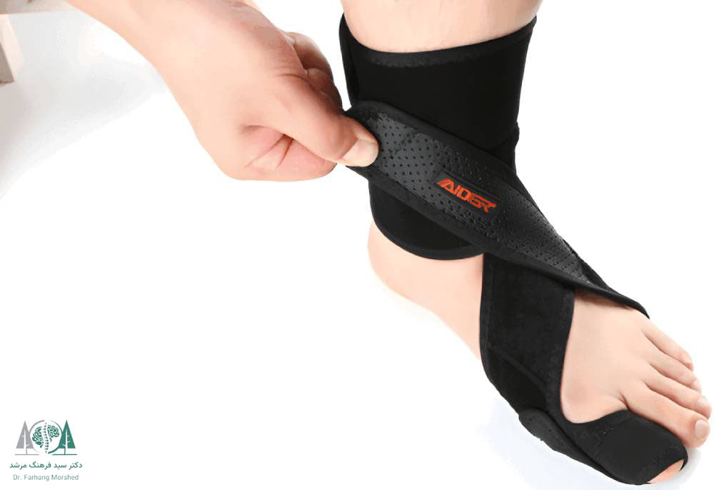 درمان افتادگی مچ پا با استفاده از ارتزها