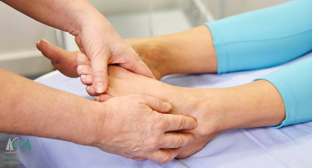 درمان افتادگی مچ پا با فیزیوتراپی و حرکات اصلاحی