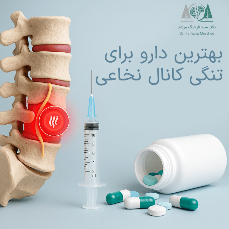 بهترین دارو برای تنگی کانال نخاعی