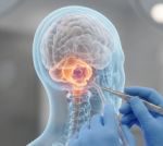 دکتر فرهنگ مرشد 10 e93eef09d7a7ee7e6b756dd13c1e388c359056cd