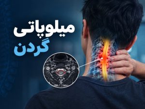 دکتر فرهنگ مرشد 13 میلوپاتی گردن